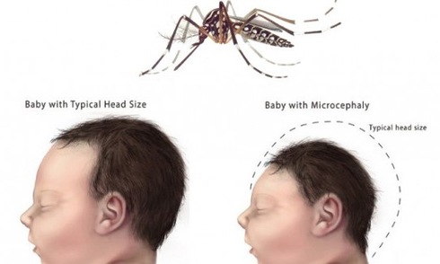 Việt Nam đã làm gì với “cơn ác mộng” mang tên virus Zika